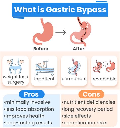 gastric sleeve leak symptoms|Gastrointestinal Complications After Gastric Bypass Surgery